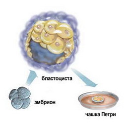 эмбриональные стволовые клетки