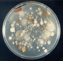 пространственный масштаб микроэволюции у бактерий оказался не более 2 см2