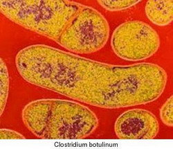 история изучения clostridium botulinum