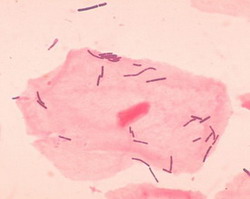 лактобактерии