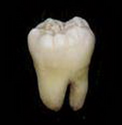 зубы биоинженерной мудрости, в японии вырастили первый биоинженерный зуб
